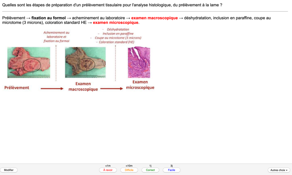 Exemple de carte Anki : les étapes de préparation d’un prélèvement tissulaire, du prélèvement à la lame